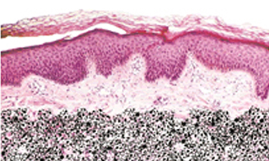 ピコレーザー照射後のイメージ